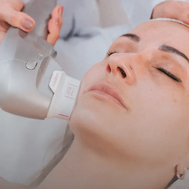 HIFU treatment at Aline Brito Beauty Clinic
